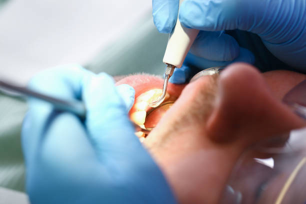 Best Broken or Cracked Tooth Emergency Dentist in Boone, IA