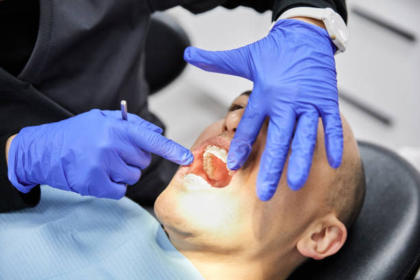 Best Emergency Dentist for Lost Fillings or Crowns in Boone, IA